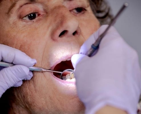 A senior woman undergoing a dental exam