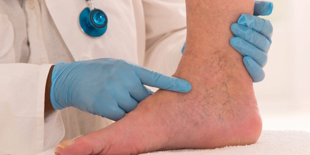 doctor showing when to worry about varicose veins